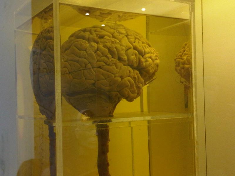 Einstein brain image 2